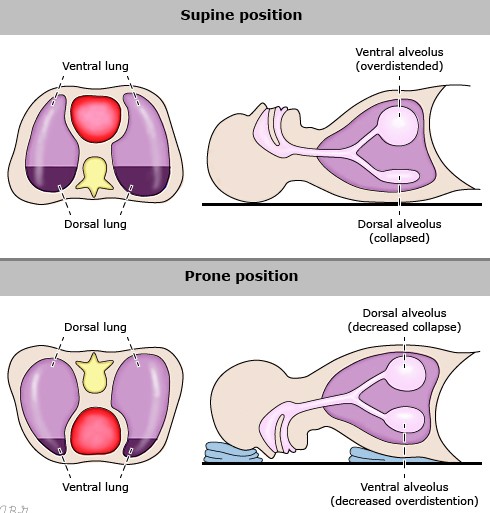 Prone vs. Supine: The Simple Difference